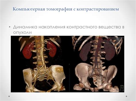 Механизмы накопления контрастного вещества в опухолях