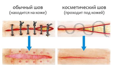 Одежда и раны