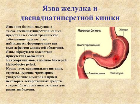 Пищевое воздействие и заболевания пищеварительной системы