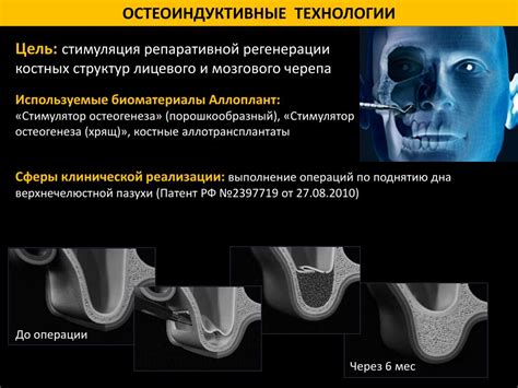 Примеры применения биоматериалов в стоматологии