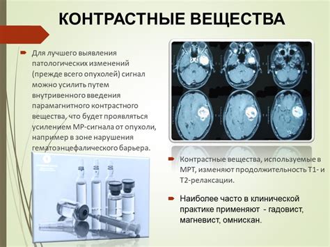 Причины возникновения опухоли, накапливающей контрастное вещество