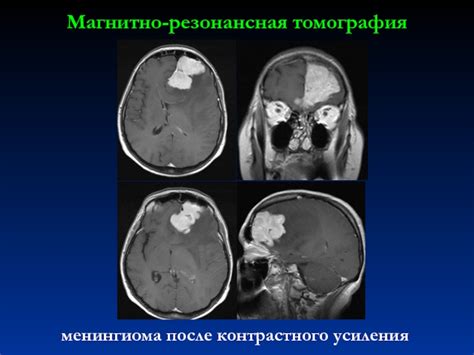 Роль контрастного вещества в диагностике опухолей